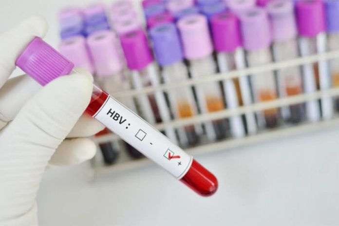 virus