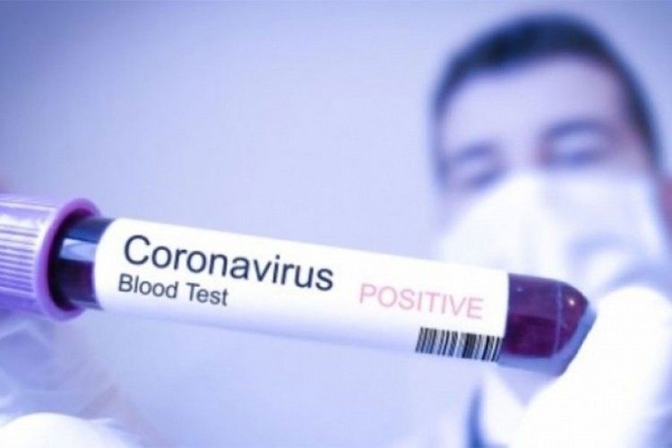 virus