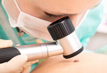 RAK KOŽE JE SVE ČEŠĆI: EVO NA ŠTA MORATE OBRATITI PAŽNJU